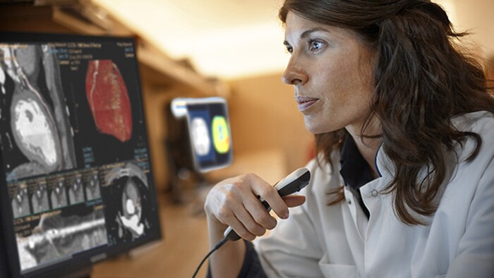 Cardiólogo que adquiere imágenes con Spectral CT para el diagnóstico de la coronariopatía