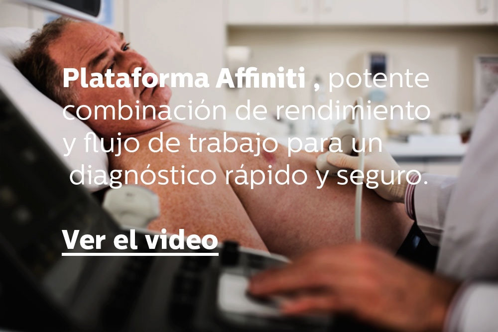 Affiniti 70 ADB 0246