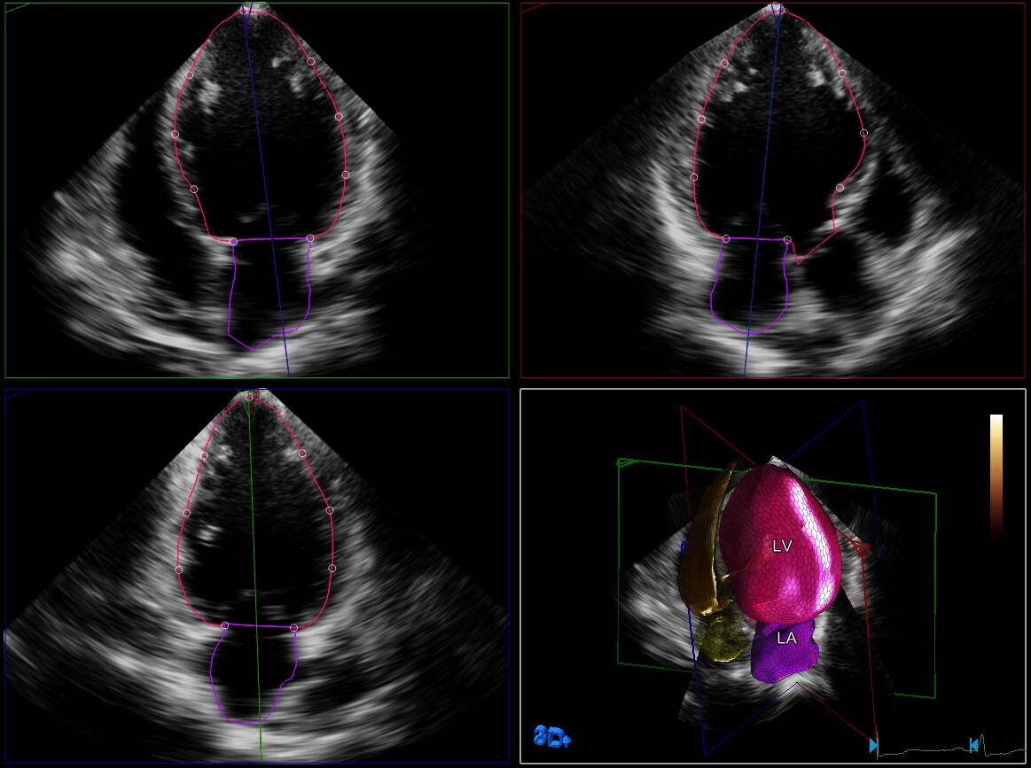 clinical image