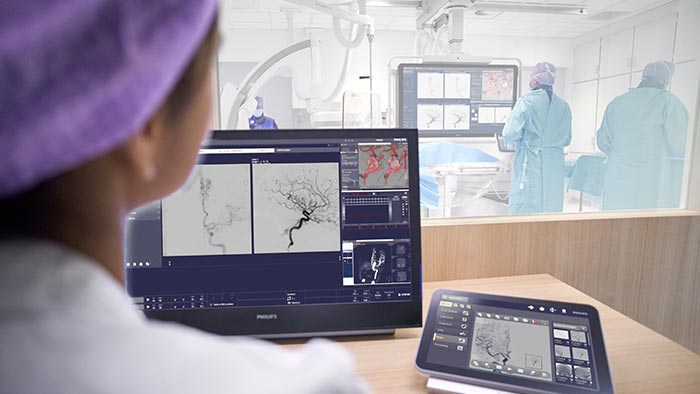 Atención neurovascular