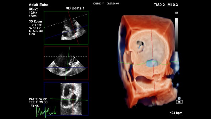 Reproducción con TrueVue con zoom 3D para LAA con visualización MultiVue