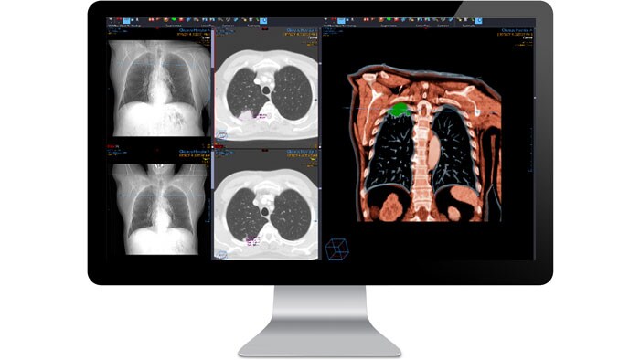 Pantalla de la interfaz del módulo de diagnóstico de radiología en un monitor