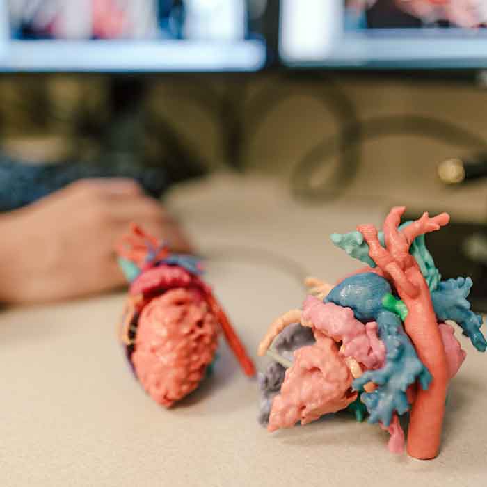 Laboratorio de impresión cardiaca en 3D de Phoenix