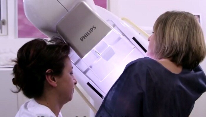 Las mujeres del xDonna Institute and Groupe 3R de Suiza hablan de las mamografías realizadas con el sistema fácil y rápido MicroDose SI.