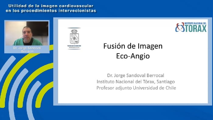 Fusión 3D de eco transesofágico con fluoroscopia en vivo en el tratamiento de enfermedades estructurales – Dr. Jorge Sandoval