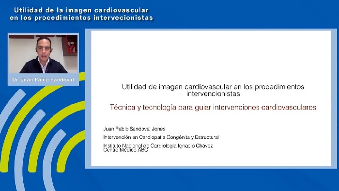Técnica y Tecnología para guiar intervenciones cardiovasculares - Dr. Juan Pablo Sandoval