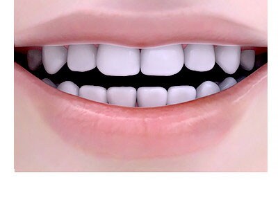 whitening