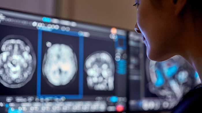Philips presenta nuevas innovaciones habilitadas por IA en #RSNA23 que liberan a los proveedores de atención médica para centrarse en la atención al paciente